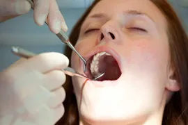 A young woman receive the benefits of a thurough teeth cleaning